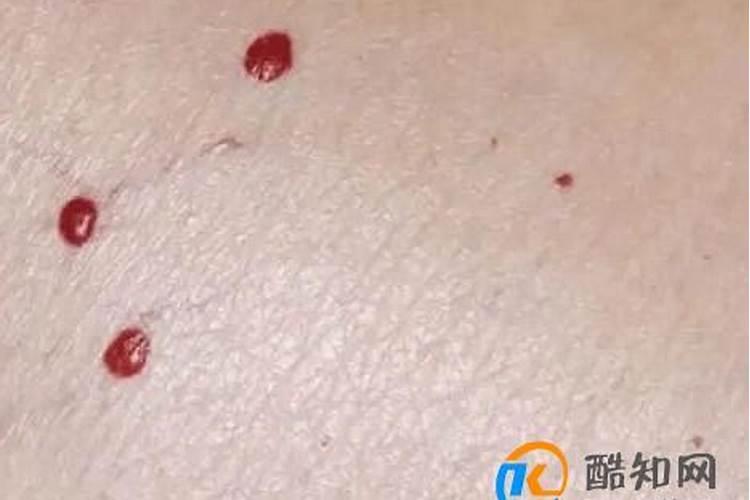 梦见水和红血什么预兆？