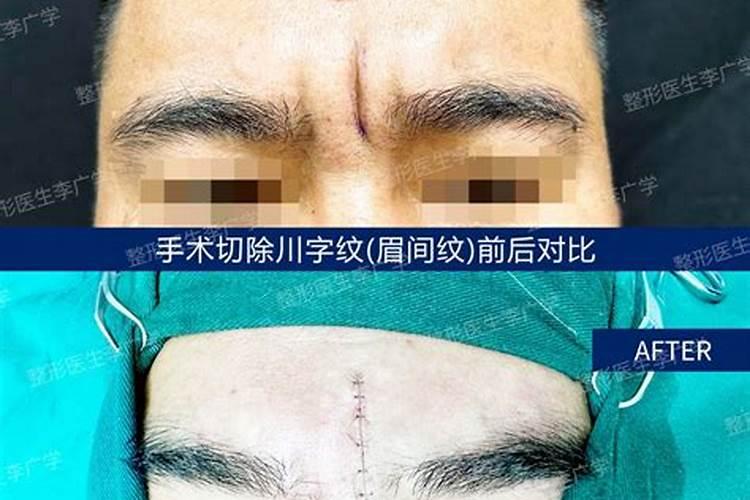 川字纹真的会影响运势吗？-易用国学