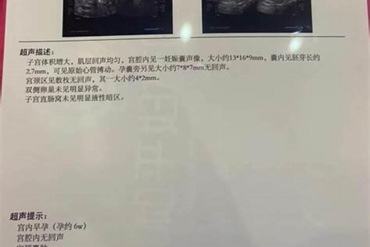 打胎要怎样安抚胎灵？