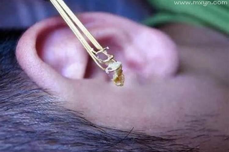 梦见耳朵里掏出很多耳屎？