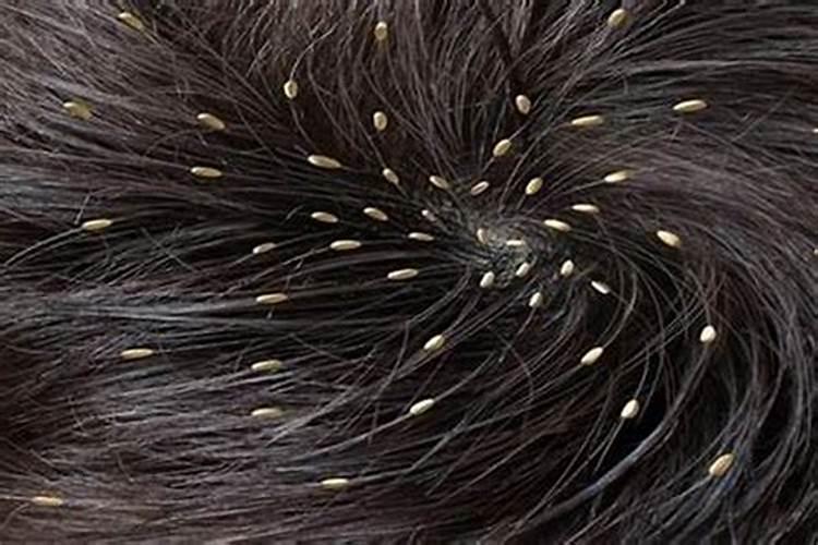 梦到孩子头上长虱子是怎么回事？