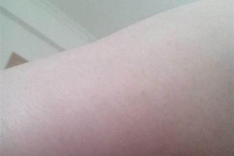 小腿内侧有痣什么运势？