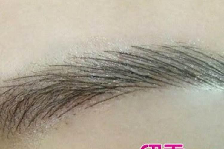 眉毛脱落是什么预兆？