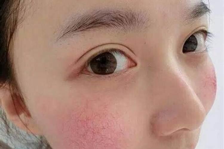 梦见看见别人脸发红怎么回事？