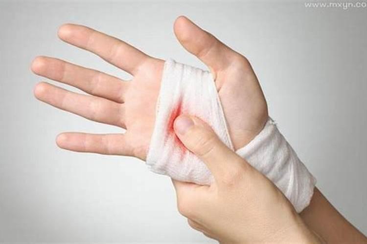 梦见手受伤是什么意思？
