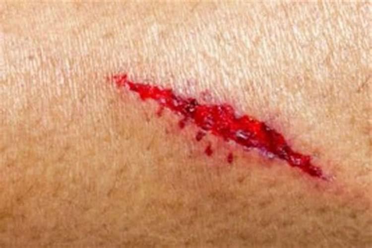 梦见被别人划伤流血