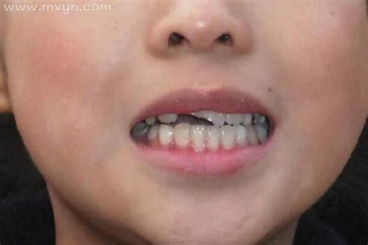 梦见掉门牙是什么征兆？