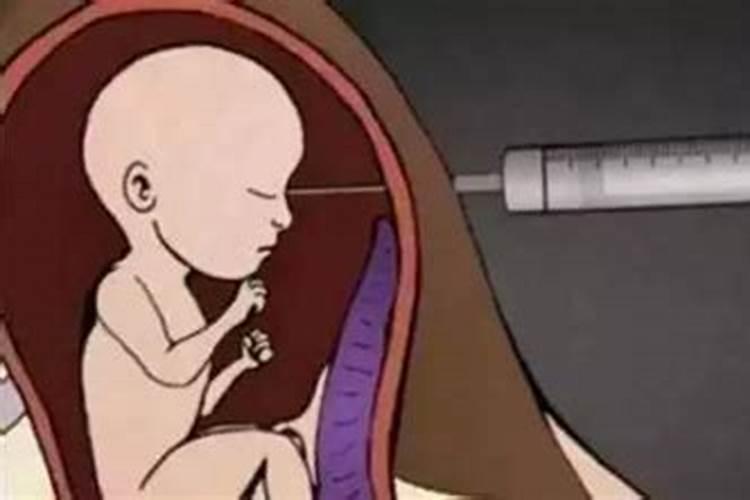 堕胎对运气的危害