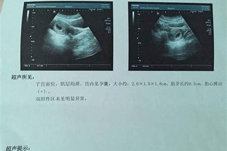 宫外孕堕胎超度