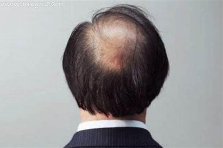 梦见自己秃顶预示着什么？