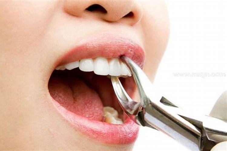 带缘分的人梦见拔牙