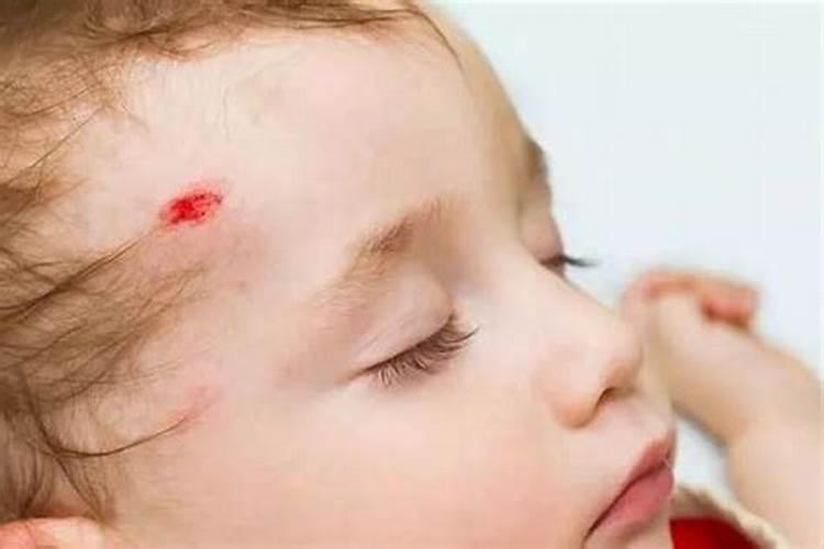 孩子总是磕碰和风水有关吗？