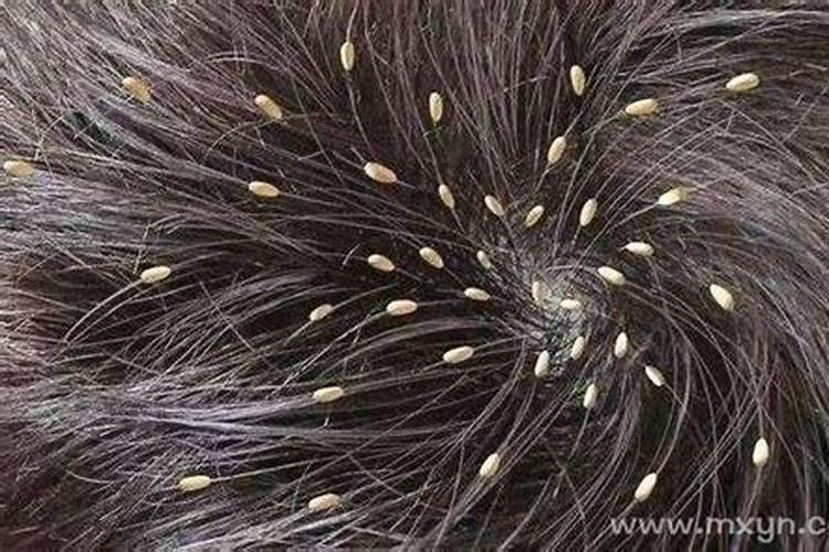 梦见孩子头上长虱子是什么预兆？