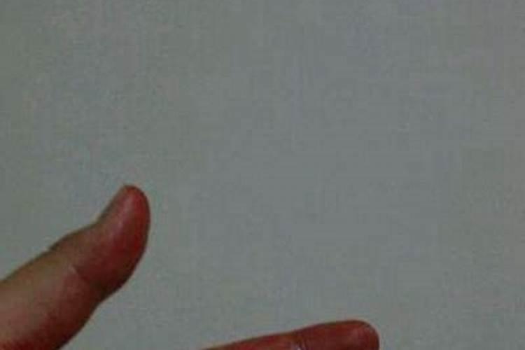 梦到自己划伤手出血了