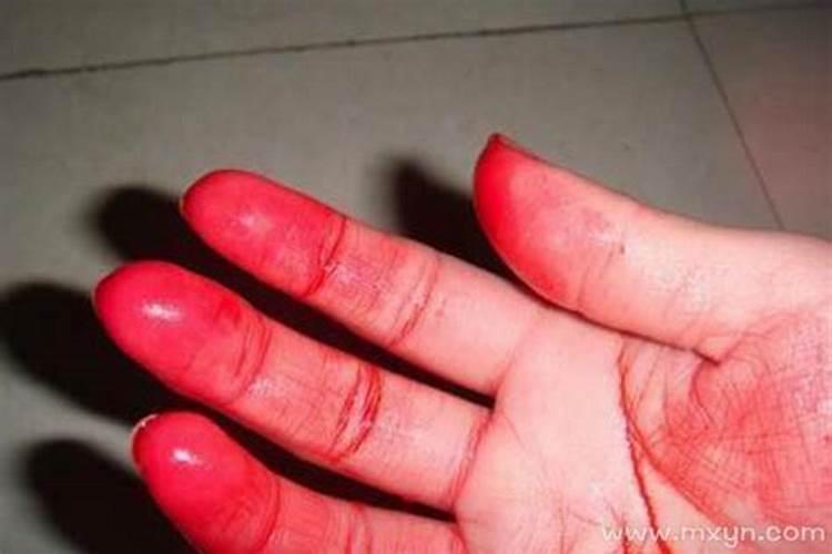 梦见手流血是什么预兆什么意思啊？