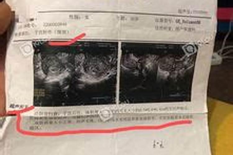 流产属于阴债吗？