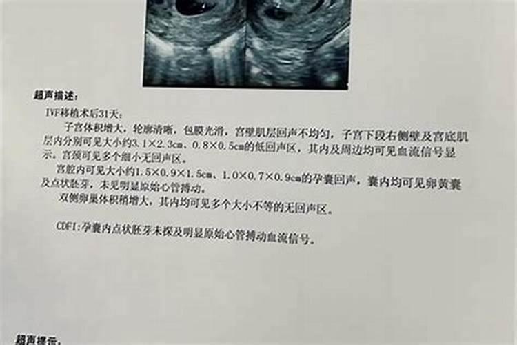 做法事怀孕换胎