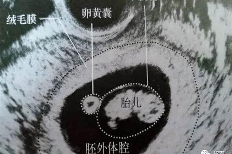 流产胎囊埋哪里比较好？