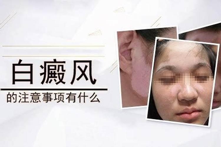 冬至白癜风注意事项