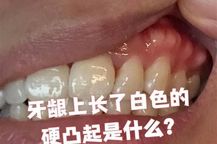 梦见前夫嘴里长了很长的牙齿