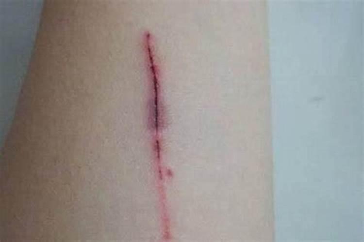 梦见脚被刀子划出血