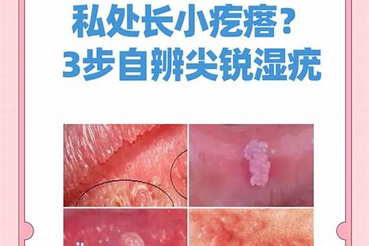 小年糕是咋回事