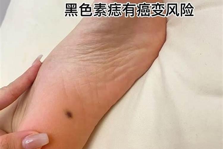 女的脚底长痣婚姻不顺
