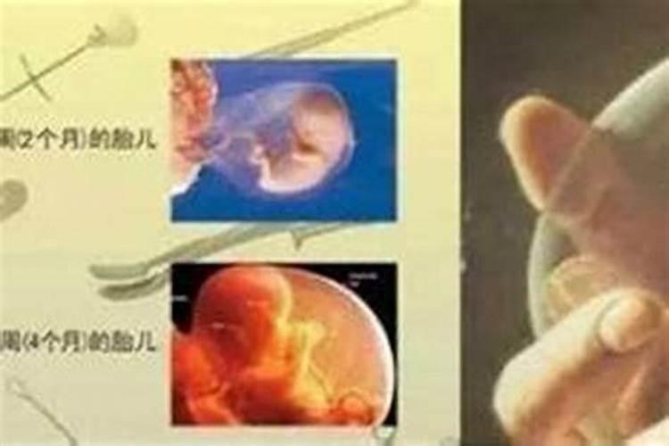 堕胎一个看到两个婴灵