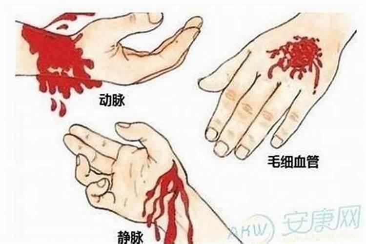 梦见手流血什么征兆周公解梦？