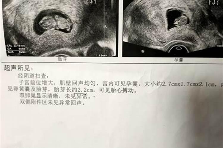 怀孕期间能做法事吗？
