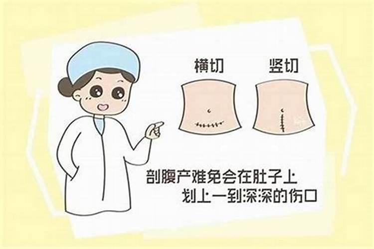 剖腹产怎么选日子？