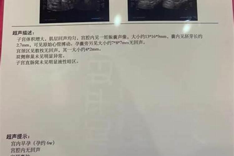 打胎后如何去化解胎儿怨气？