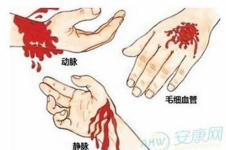 梦见手受伤流血好不好？